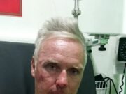 Tragedi Keluarga di Bali, Paul Diserang Secara Brutal di Depan Rumah Mantan Istri